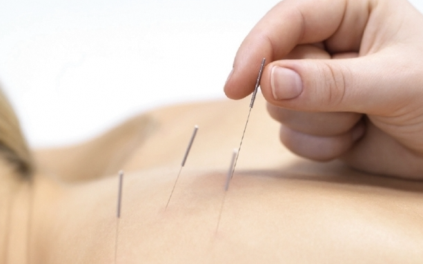 L'acupuntura tracta diverses afectacions FOTO: Cedida
