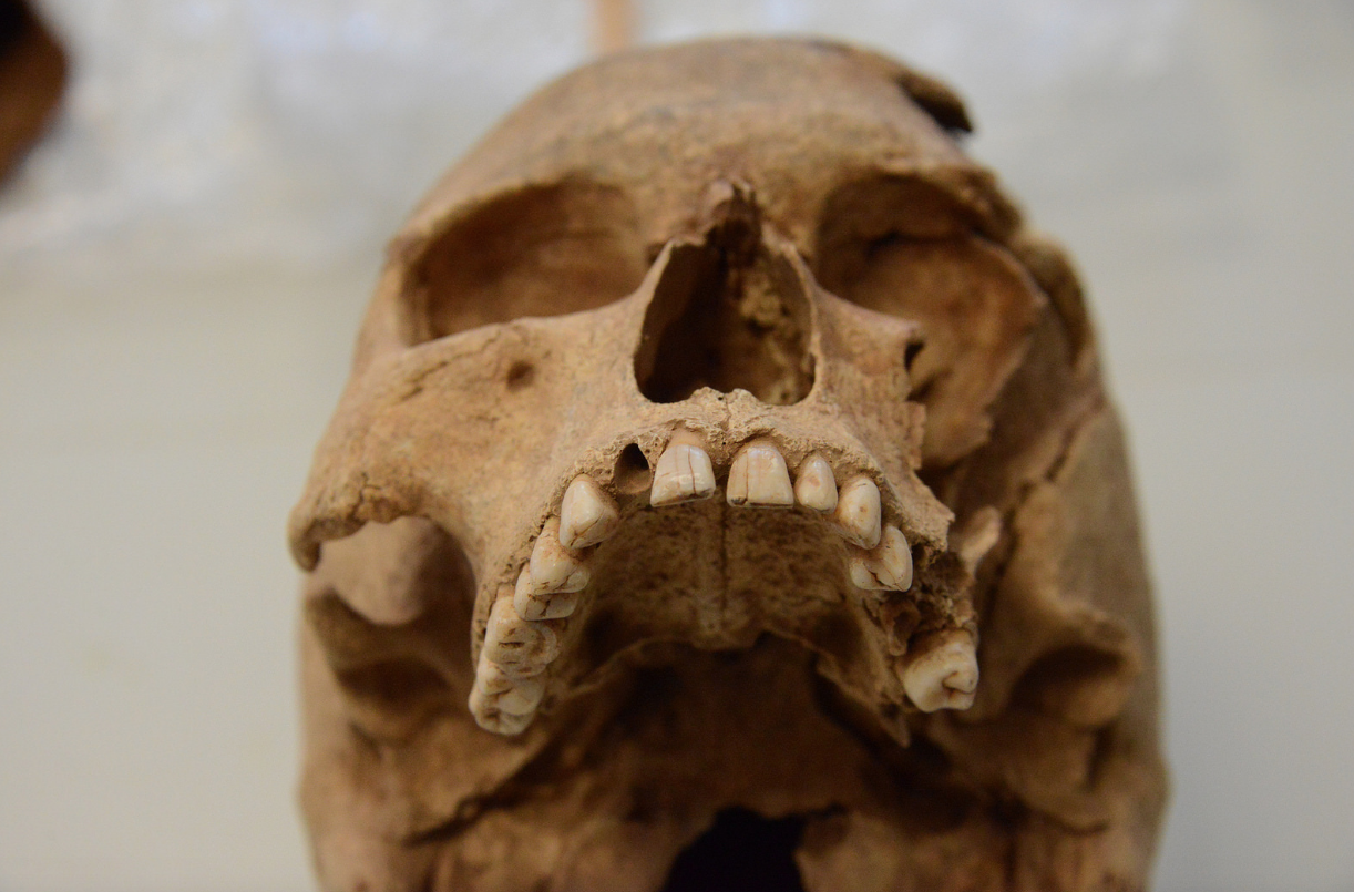 Crani d'un habitant de Sant Cugat de l'època tardo-romana FOTO: Localpres