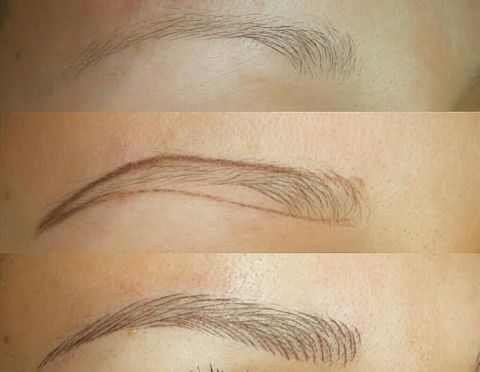Abans de començar el microblading, s'aplica una crema anestèsica tòpica i un anestèsic en gel FOTO: Cedida Abans de començar el microblading, s'aplica una crema anestèsica tòpica i un anestèsic en gel FOTO: Cedida