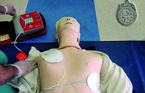 Els DEA són dispositius mèdics que permeten identificar les cardiopaties coronàries