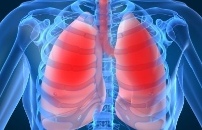 La pneumònia és una malaltia inflamatòria dels pulmons. FOTO: Cedida