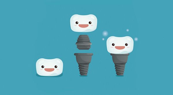 La substitució de peces dentals és molt important FOTO: Cedida 