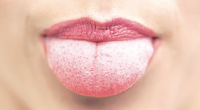  Si observeu alguna pigmentació o taca, pot ser signe que alguna cosa no vagi bé FOTO: Cedida