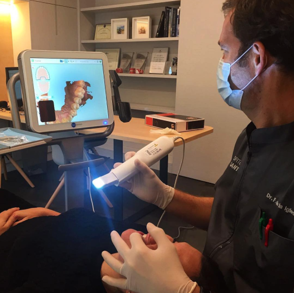 Escaneig dental amb l’Itero Elements FOTO: Cedida