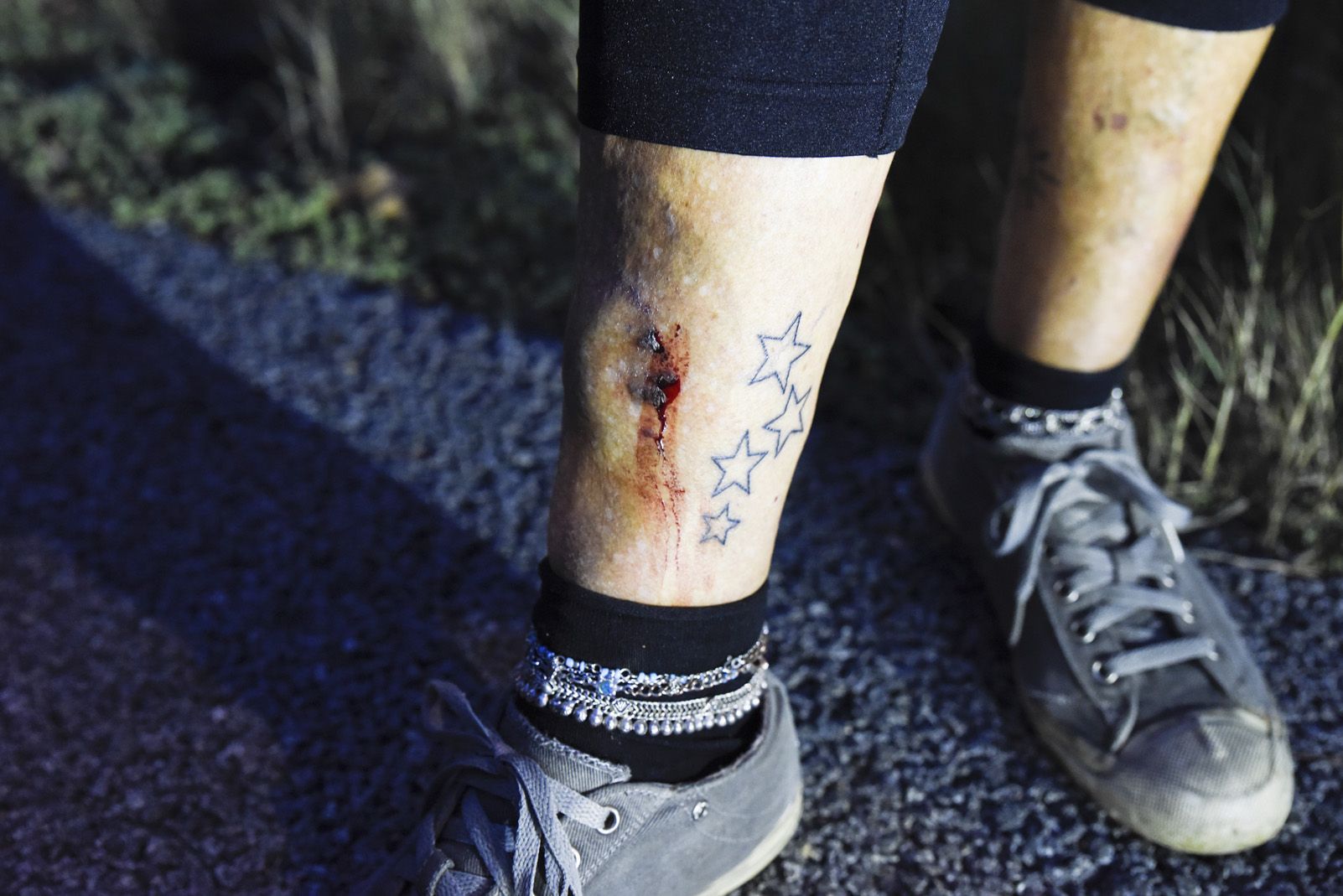 Una manifestant ferida per un cotxe. Foto: Bernat Millet.