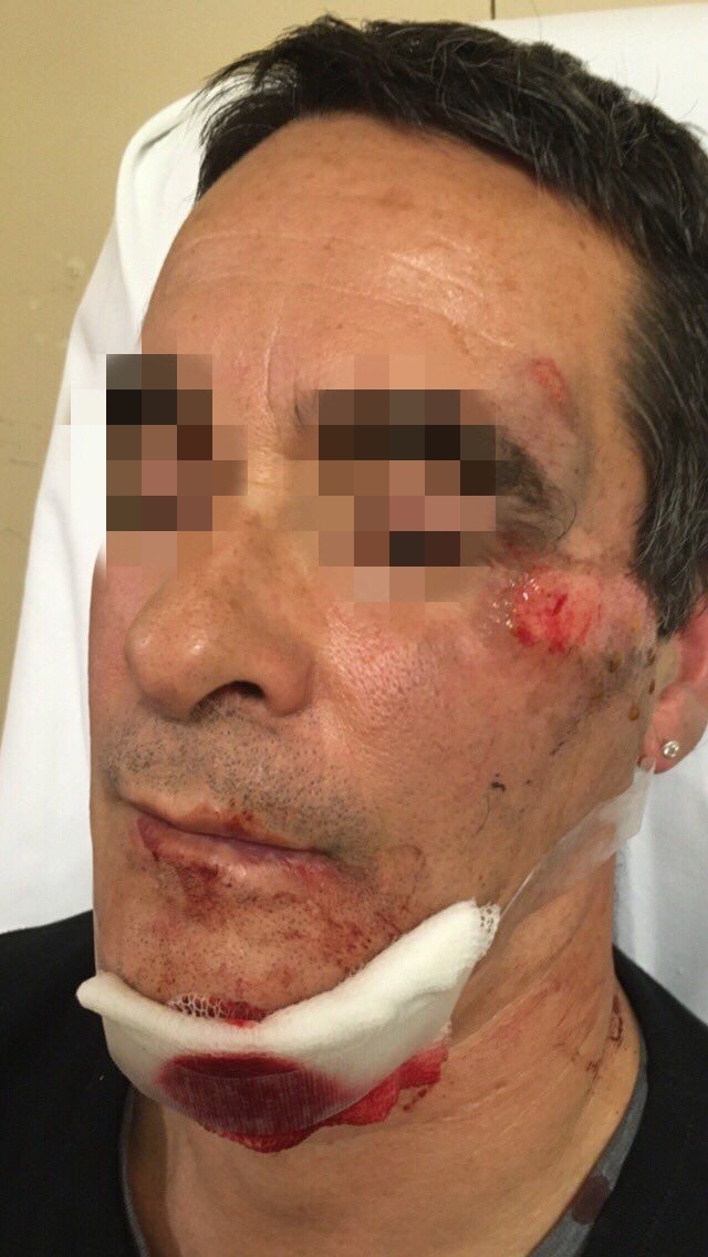 ciclista accident sant cugat