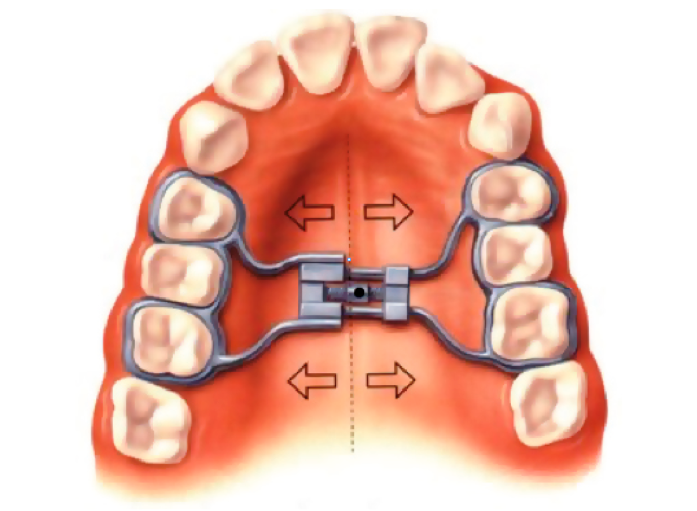 Dentadura. FOTO: Cedida