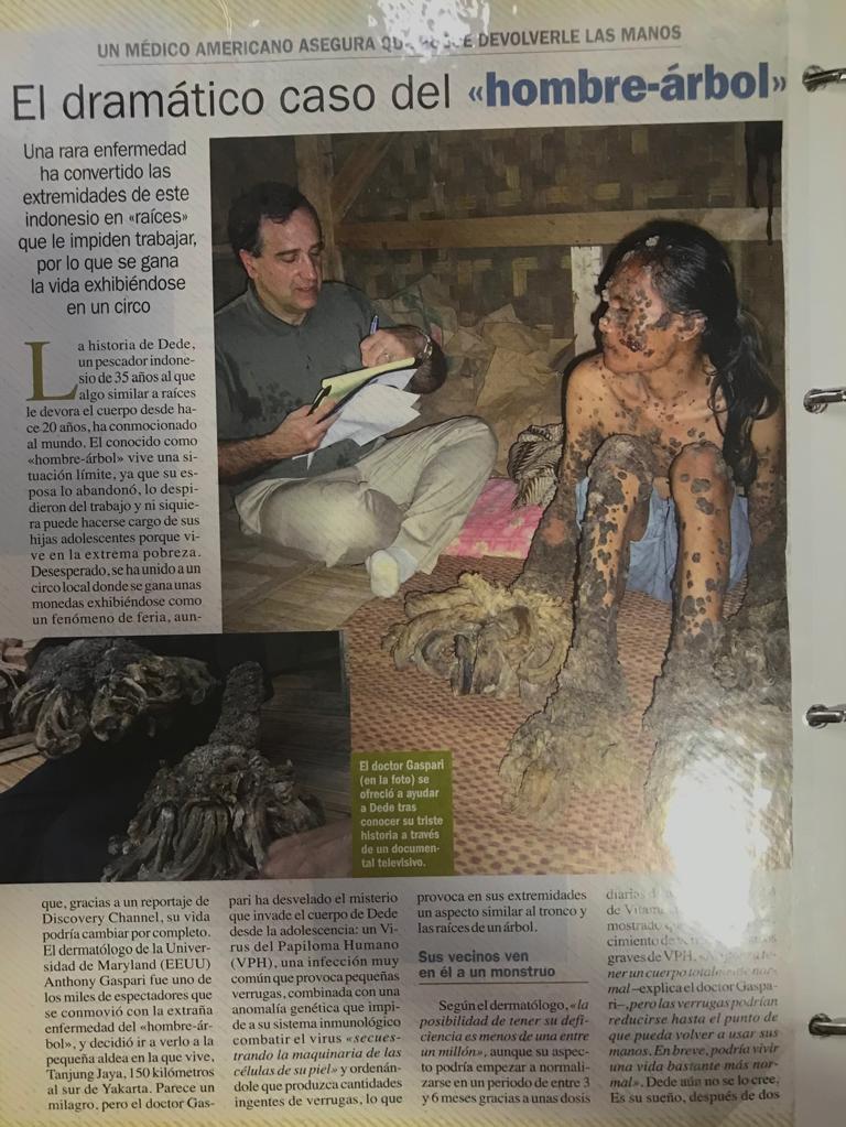 Retall de la notícia del 'home arbre' FOTO: 'TOT'