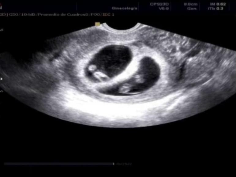 Formes de vida · Hospital FOTO: Beatriz Ardevol Caamaño