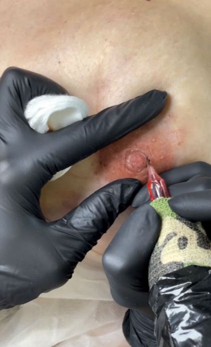 Les tècniques i els resultats són totalment naturals i sense dolor FOTO: Cedida