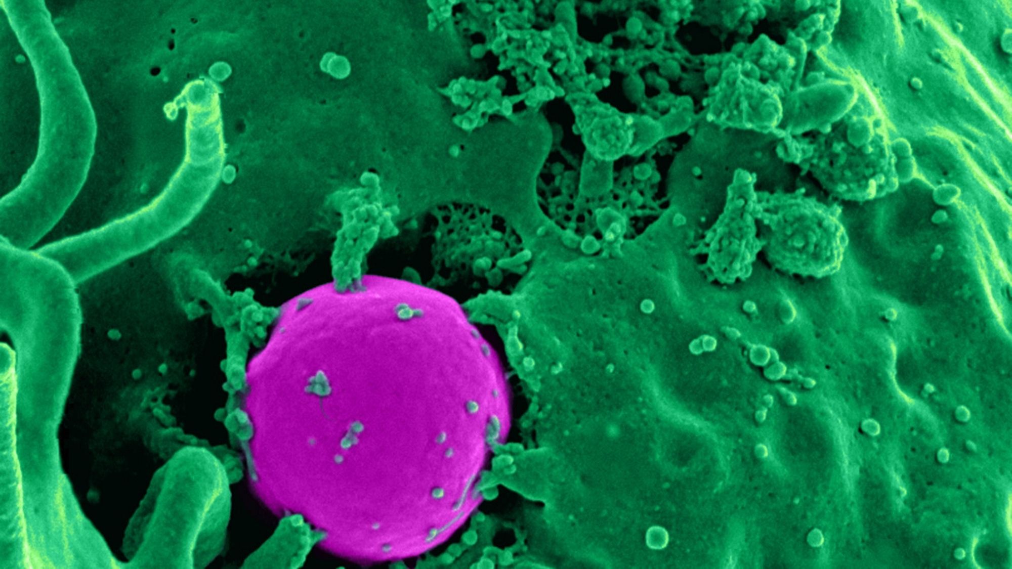 Immunoteràpia